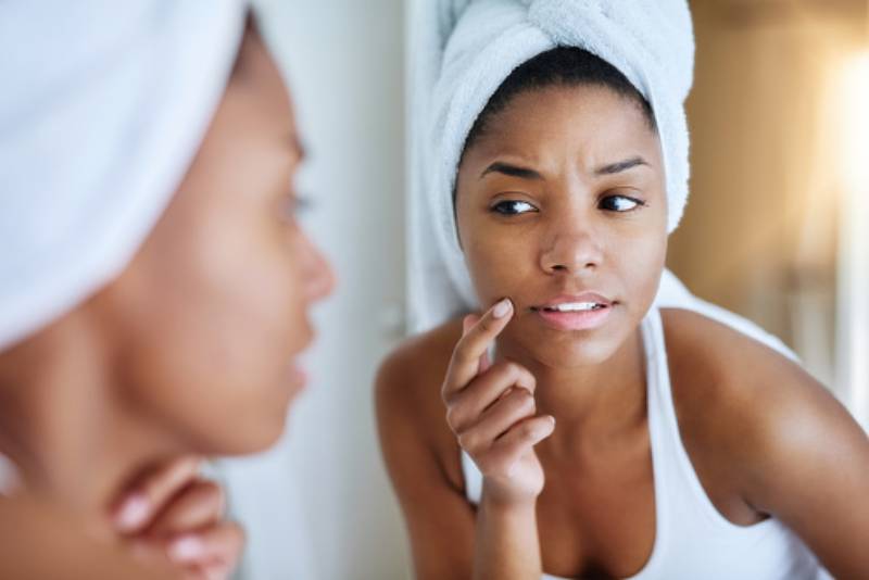4 Skincare Questions You’re Too Afraid to Ask