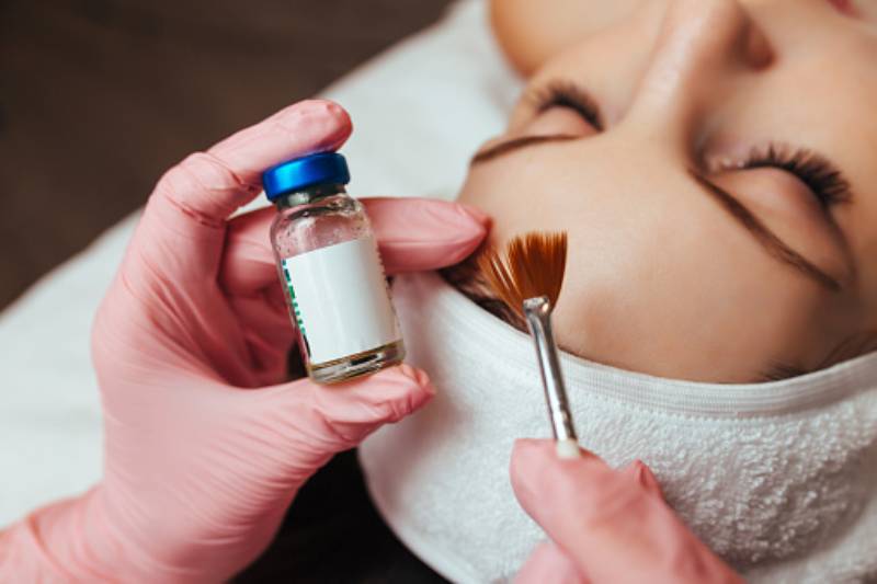 Do chemical peels age your skin?