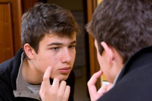 Read more about the article A Guide to Teenage Acne