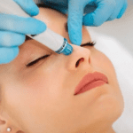 Hydrafacial