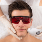 laser hair removal