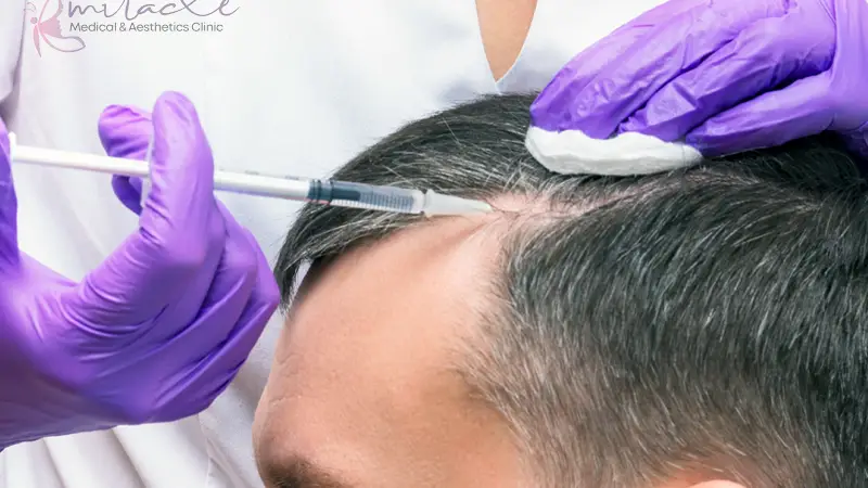 PRF Hair Restoration in Vaughan | Natural Hair Regrowth