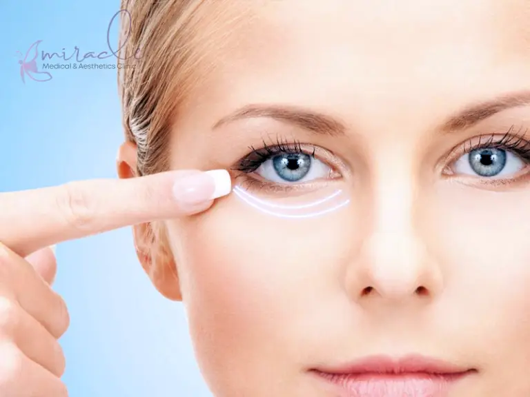 PRP under-eye treatment for dark circles in Vaughan